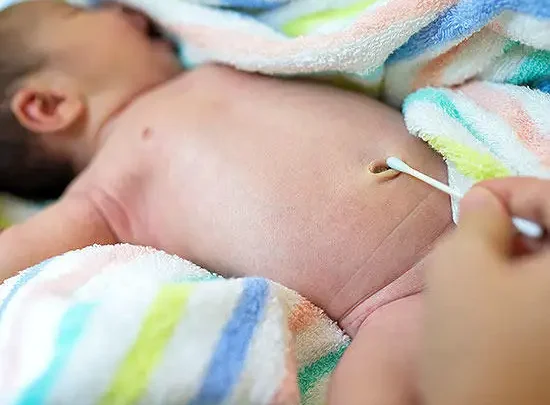 pusar bayi berdarah